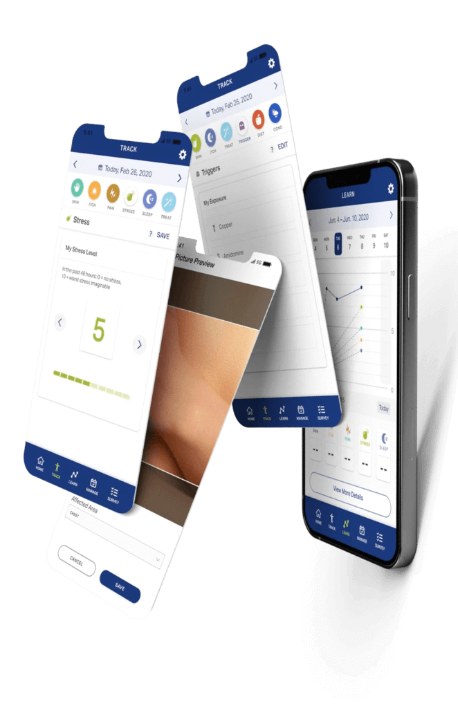 National Eczema Association Dogtown Media